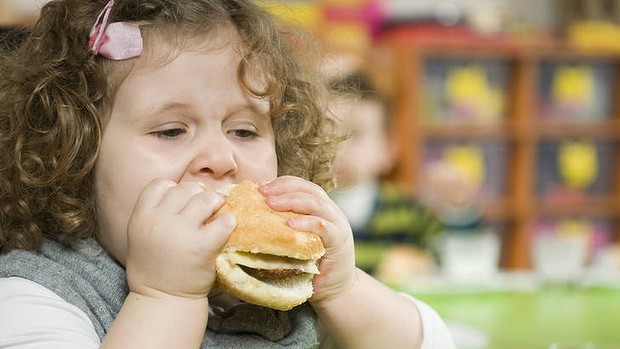CHILDHOOD OBESITY IN AUSTRALIA